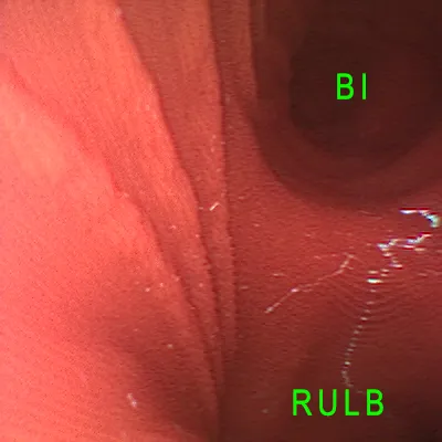 Beschriftete Innenansicht des Bronchoskopie-Trainers mit BI und RULB