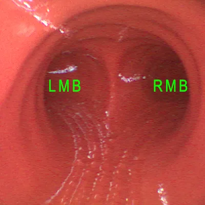 Beschriftete Innenansicht des Bronchoskopie-Trainers mit LMB und RMB