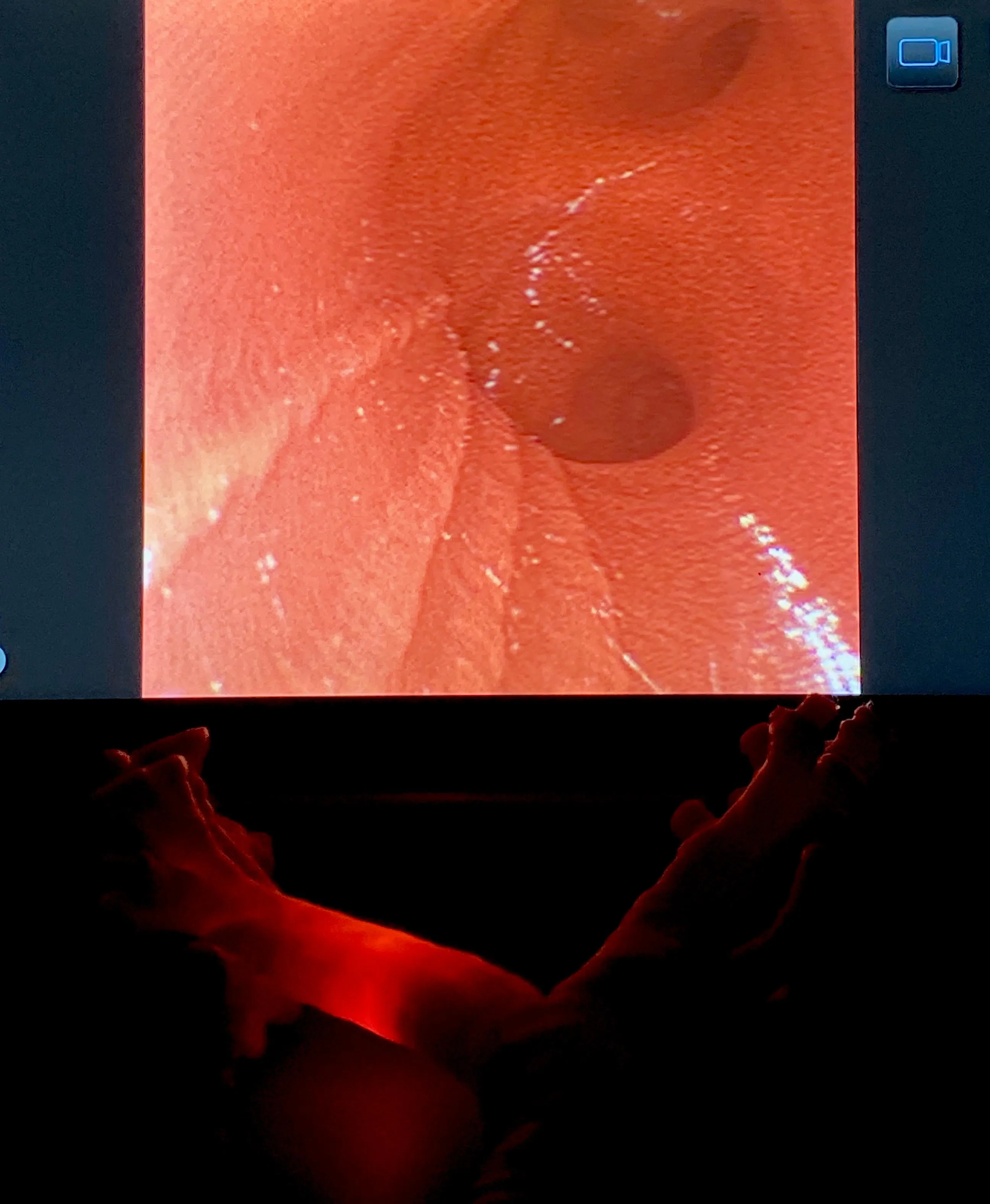 Innenansicht des Bronchoskopie-Trainers mit sichtbarer Pars membranacea – linke Perspektive