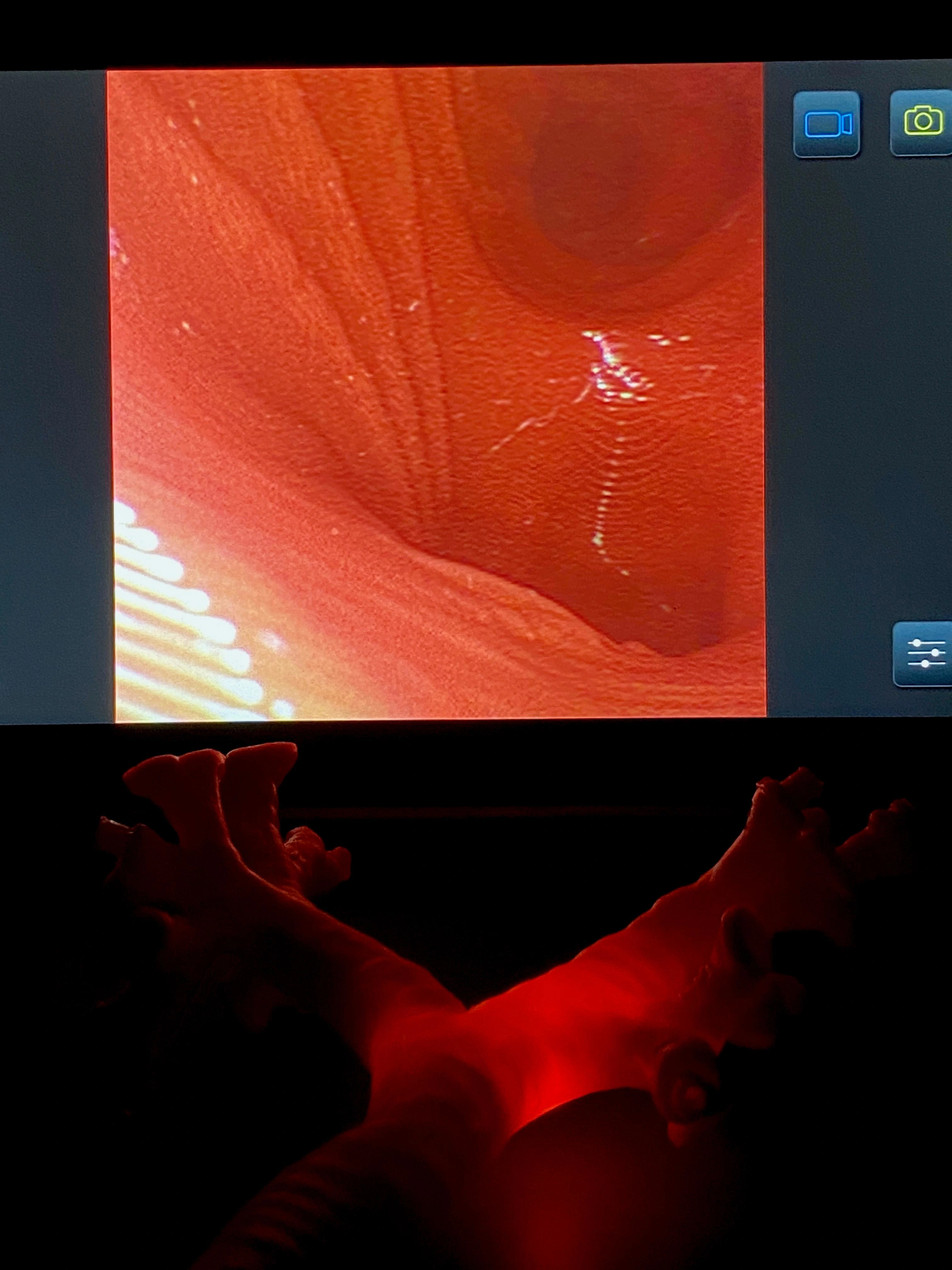 Innenansicht des Bronchoskopie-Trainers mit sichtbarer Pars membranacea – rechte Perspektive